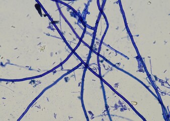 soil microorganisms under a microscope including amoeba, flagellates, nematodes, fungi, bacteria	

