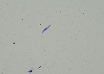 soil microorganisms under a microscope including amoeba, flagellates, nematodes, fungi, bacteria	
