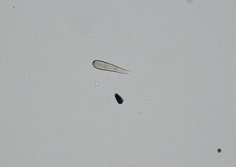 soil microorganisms under a microscope including amoeba, flagellates, nematodes, fungi, bacteria	
