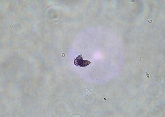 soil microorganisms under a microscope including amoeba, flagellates, nematodes, fungi, bacteria	
