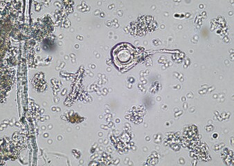 soil microorganisms under a microscope including amoeba, flagellates, nematodes, fungi, bacteria	
