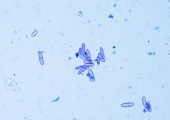 soil microorganisms under a microscope including amoeba, flagellates, nematodes, fungi, bacteria	
