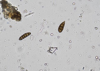 soil microorganisms under a microscope including amoeba, flagellates, nematodes, fungi, bacteria	
