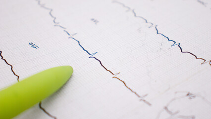 stock market graph on white