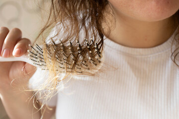 Hair loss problem, sparse porous fluffy hair, alopecia