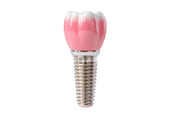 Dental implant with pink crown and metallic screw base isolated on transparent background