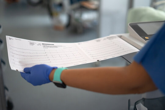 Doctor or nurse reviewing patient's ecg heart test results for diagnosis - Powered by Adobe