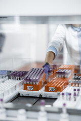 laboratory for research of tests, the doctor loads into the research device