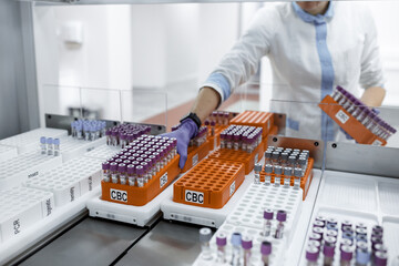 laboratory for research of tests, the doctor loads into the research device