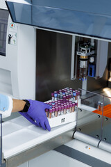 laboratory for research of tests, the doctor loads into the research device