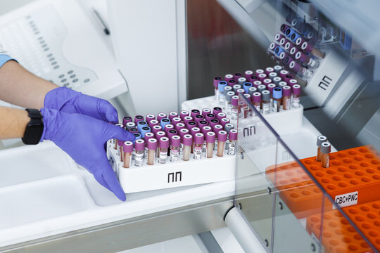 laboratory for research of tests, the doctor loads into the research device