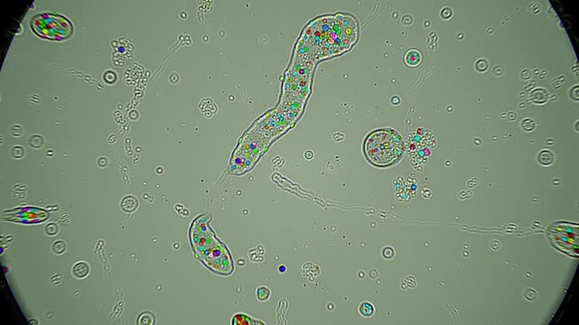Microscopic view of Euglena and other microorganisms in pond water under a microscope.
