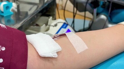 Close Up Shot Of female hand Blood Donor With an Attached Catheter. Donation For Organ Transplant Patients.