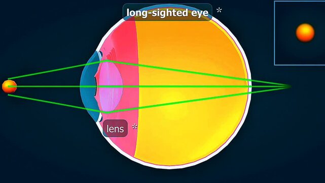 Long sighted eye nearby object