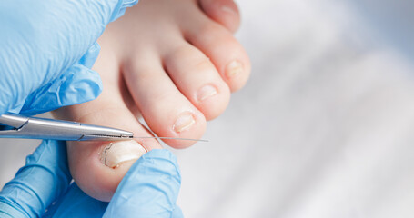 Closeup of podiatrist treating toenails of mature caucasian female patient