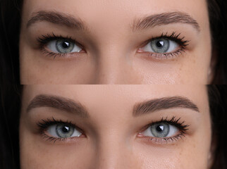 Obraz premium Eyebrow correction, collage. Photos of woman before and after treatment, closeup