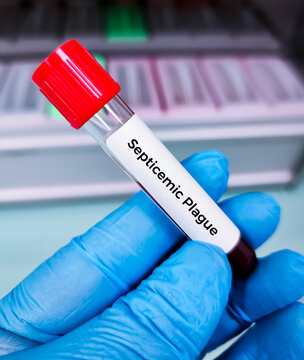 Blood sample for Plague test. It's one of three types of plague caused by the bacterium Yersinia pestis,Pneumonic plague,septicemic plague.