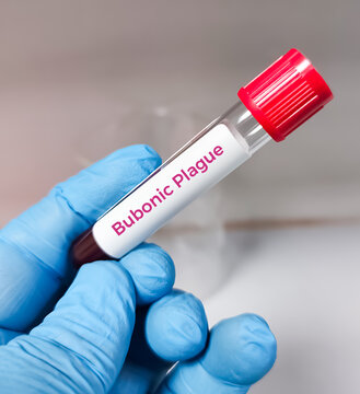 Blood sample for Plague test. It's one of three types of plague caused by the bacterium Yersinia pestis,Pneumonic plague,septicemic plague.