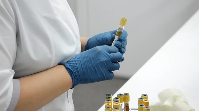 Close up of lab technician hands in gloves applying barcode label on test tube with blood plasma or urine sample for medical analysis in clinical laboratory indoors.
