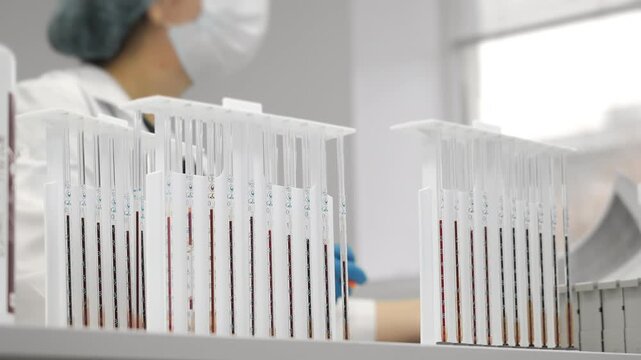 Medical laboratory worker monitoring erythrocyte sedimentation rate ESR test tubes with blood samples during clinical analysis in modern diagnostic lab.