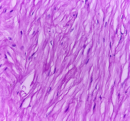 Fototapeta premium Microscopic image of seminiferous tubules showing atrophic changes, Sartoli cell are hyperplastic.