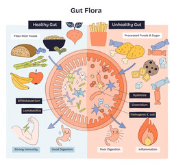 Gut flora doodle diagram contrasts healthy vs unhealthy microbiome, linking fiber foods to good digestion and sugar to dysbiosis, key objects, intestine, bacteria, foods, transparent background.