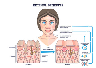 Retinol benefits outline showing how retinol boosts collagen and cell turnover, woman s face, skin cross-sections before-after, and arrows explain clearer texture and fewer wrinkles.