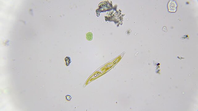 Diatom with cyanobacteria under bright field microscope at 400x magnification