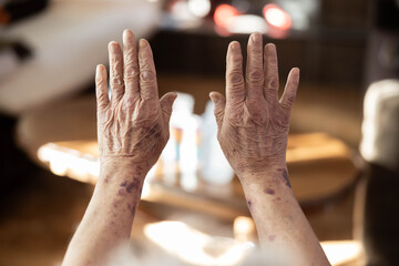 The image captures the weathered hands of an elderly person, showcasing the lines, wrinkles, and signs of aging, representing a lifetime of experiences and memories.prominent aging skin texture