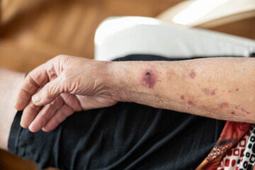This close-up of an elderly woman's hand reveals the unique patterns of age, reflecting a lifetime of experiences and the importance of compassionate care in the context of gracefully growing older.