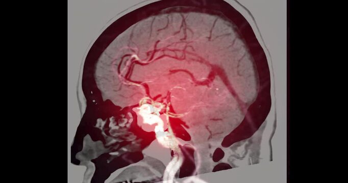 Magnetic resonance angiography of the brain shows detailed cerebral arteries. Advanced imaging technology supports precise radiology diagnosis. Useful for medical education and research.