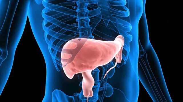 A 3D animation of acute pancreatitis showing severe inflammation of the pancreas
