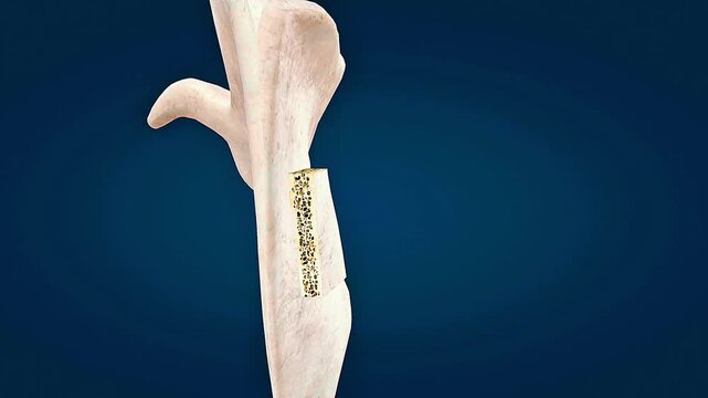  Anatomy and section of flat bone
