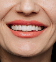 Obraz premium Closeup of straight white porcelain veneers with glossy coral lips