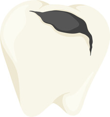 illustration tooth decay