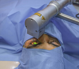 closeup photo of collagen cross linking operation for treating keratoconus