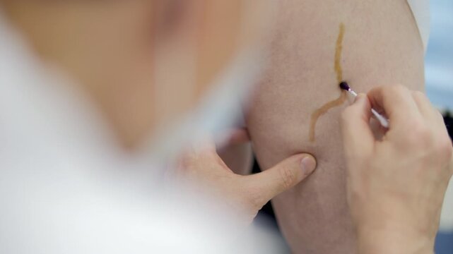 Doctor marking vein on patient leg before surgery