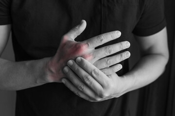 Close-up of a man holding a painful, inflamed hand. Represents injury, arthritis, wrist pain,...