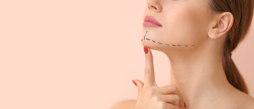 Young woman with marks on her face against color background, closeup. Concept of plastic surgery