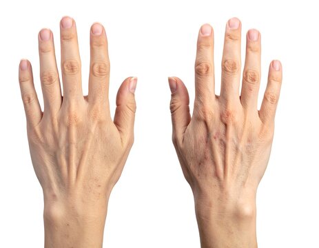 Close-up of two human hands, palms up, showcasing veins and skin texture