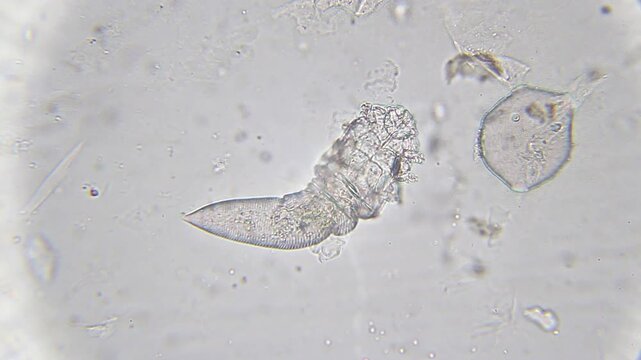 Demodex mite moving under bright field microscope at 400x magnification