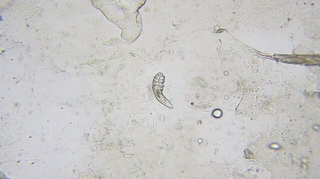 Demodex mite moving and turning under bright field microscope at 100x magnification
