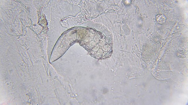 Demodex mite moving and turning under bright field microscope at 400x magnification
