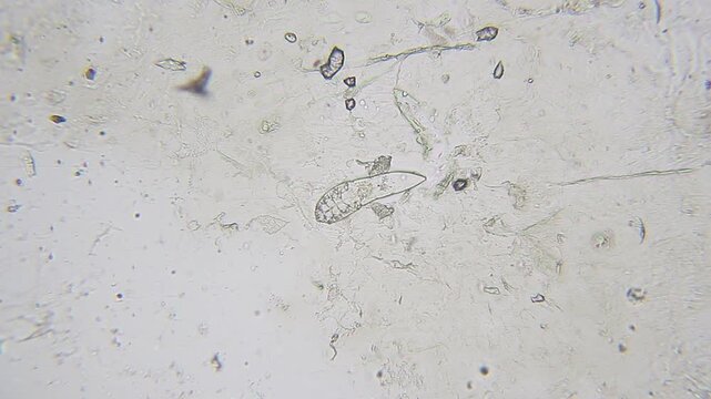 Demodex mite moving under bright field microscope at 100x magnification