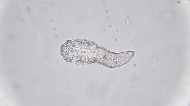 Demodex mite moving and bending its tail under bright field microscope at 400x magnification
