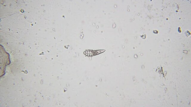 Demodex mite moving under bright field microscope at 100x magnification