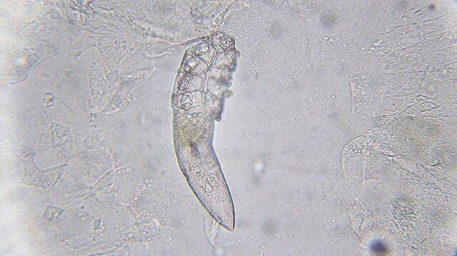 Moving Demodex mite under bright field microscope at 400x magnification