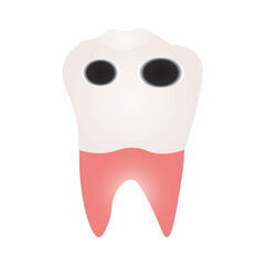 Tooth Decay Illustration