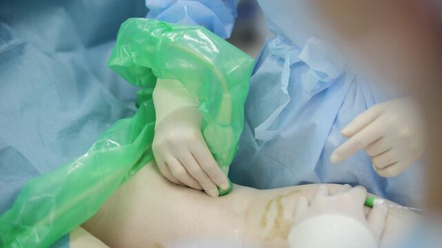 Ultrasound control during endovenous laser vein treatment
