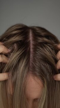 Vertical video of young blonde woman scratching head with dirty greasy hair on a light grey background. The problem of oily scalp. A girl itching the skin from long non-washes of the head. Close up